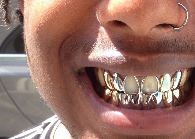 Dolly Cohen grillz
